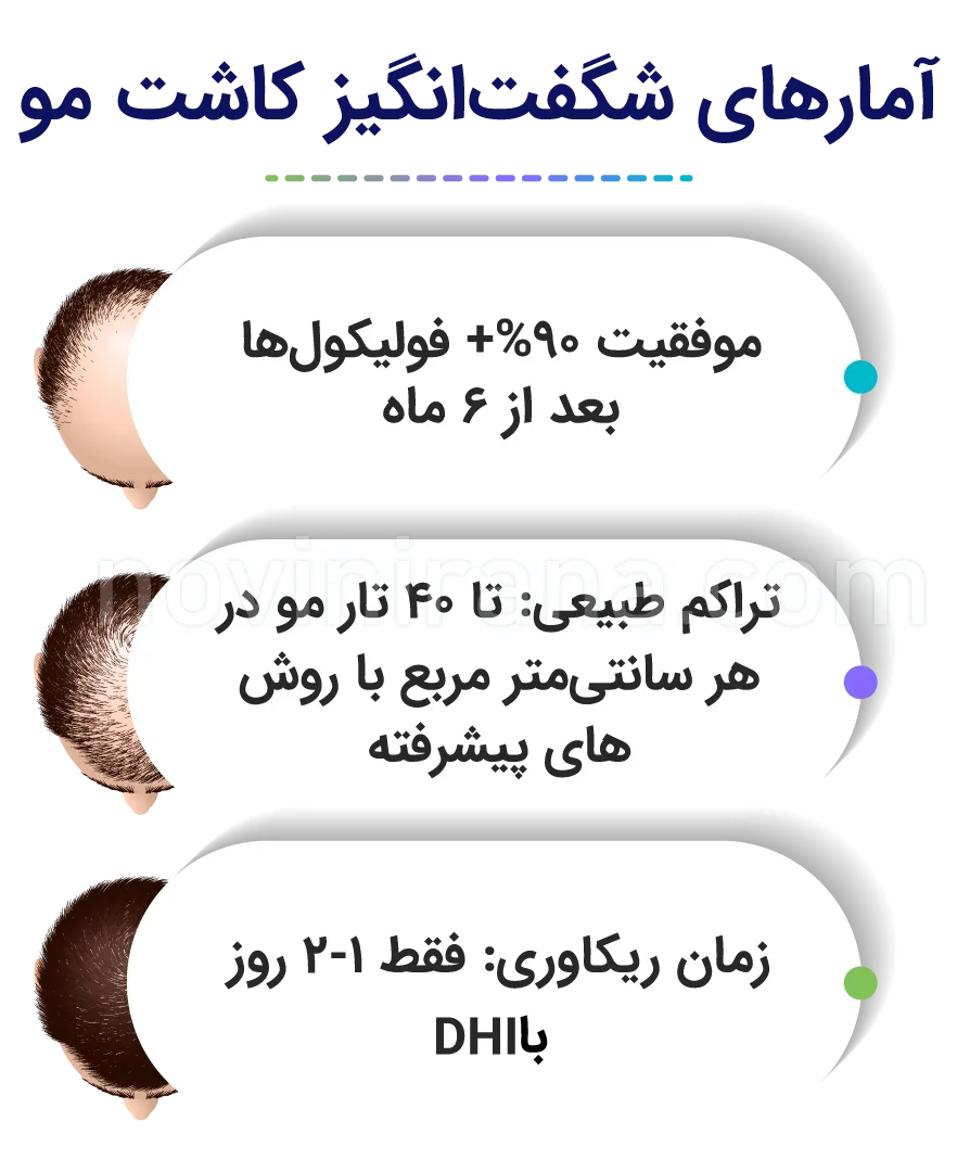 کاشت مو به روش DHI